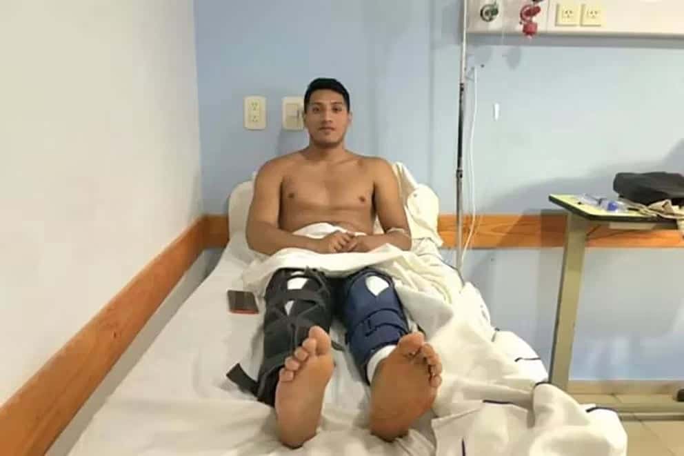 Insólito: Fue a operarse una rodilla en un sanatorio de La Plata y despertó de la anestesia con las dos intervenidas