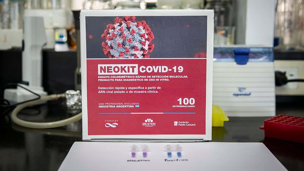 Test de Coronavirus: Provincia recibe los primeros kits argentinos anunciados por el Presidente