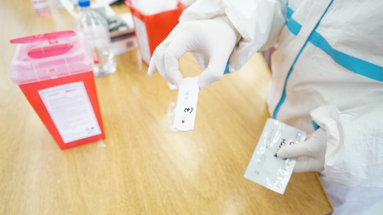 Esteban Echeverría: Municipio realiza test rápidos de coronavirus a empleados