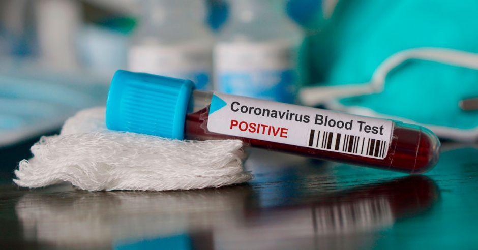 Nuevo caso de coronavirus en Berisso: 4 en total