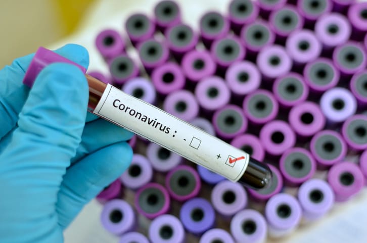 Coronavirus: Confusión en la información oficial sobre la cantidad de casos en la Provincia de Buenos Aires