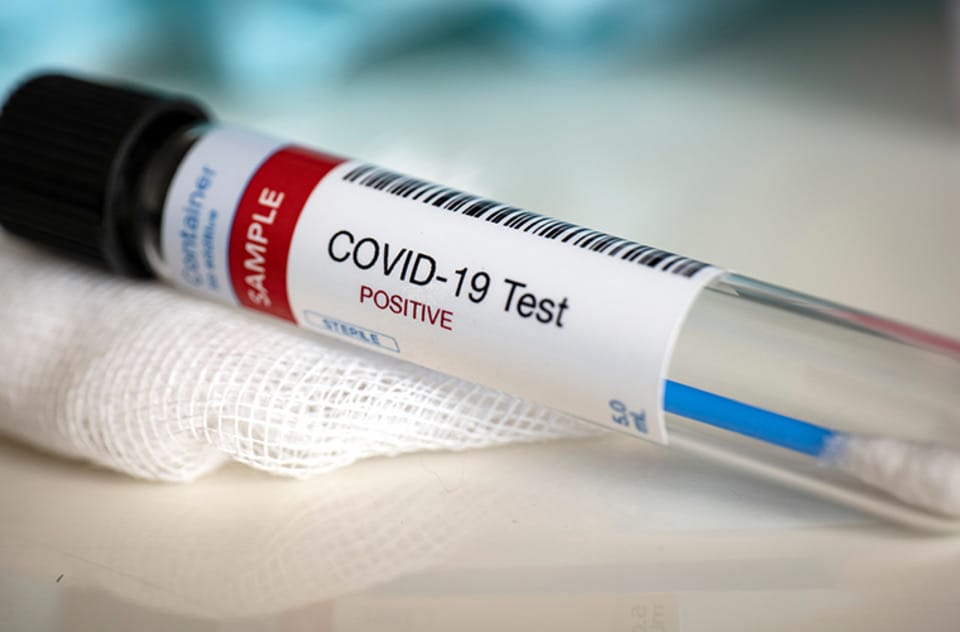 Coronavirus: 8 nuevos casos en Quilmes, 117 en total y 173 sospechosos