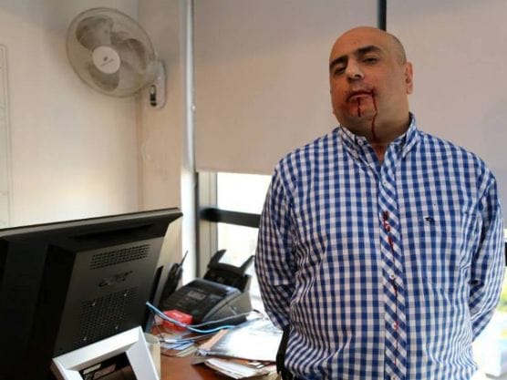 Repudio al ataque a trompadas de De Narváez a un periodista
