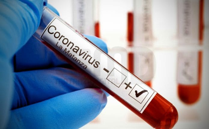 Coronavirus: La Matanza quedó cerca de la barrera de los 8 mil casos y tiene más del 10% de los fallecidos de toda la Provincia
