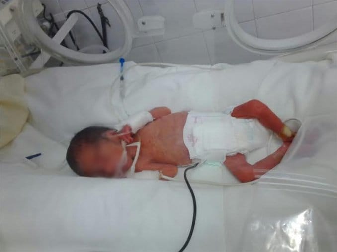 Otra vez en Benito Juárez: Nació un bebé muerto y revivió