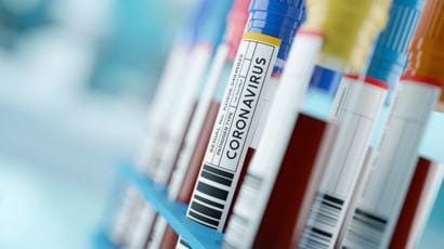 Ituzaingó: confirmaron el caso 11 de coronavirus en el distrito