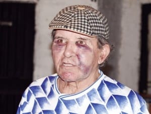 La Plata: Ataron y desfiguraron a jubilado de 72 años para robarle 