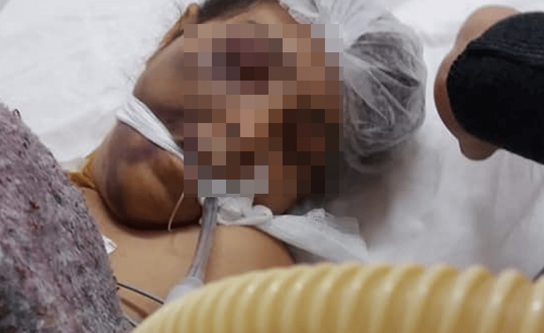 Baradero: Murió la joven discapacitada internada que había estado en APAND
