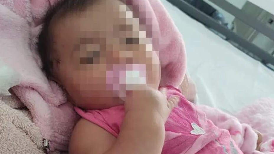 Una beba de cinco meses recibió una perdigonada en la cabeza mientras la Policía perseguía a un ladrón en Merlo