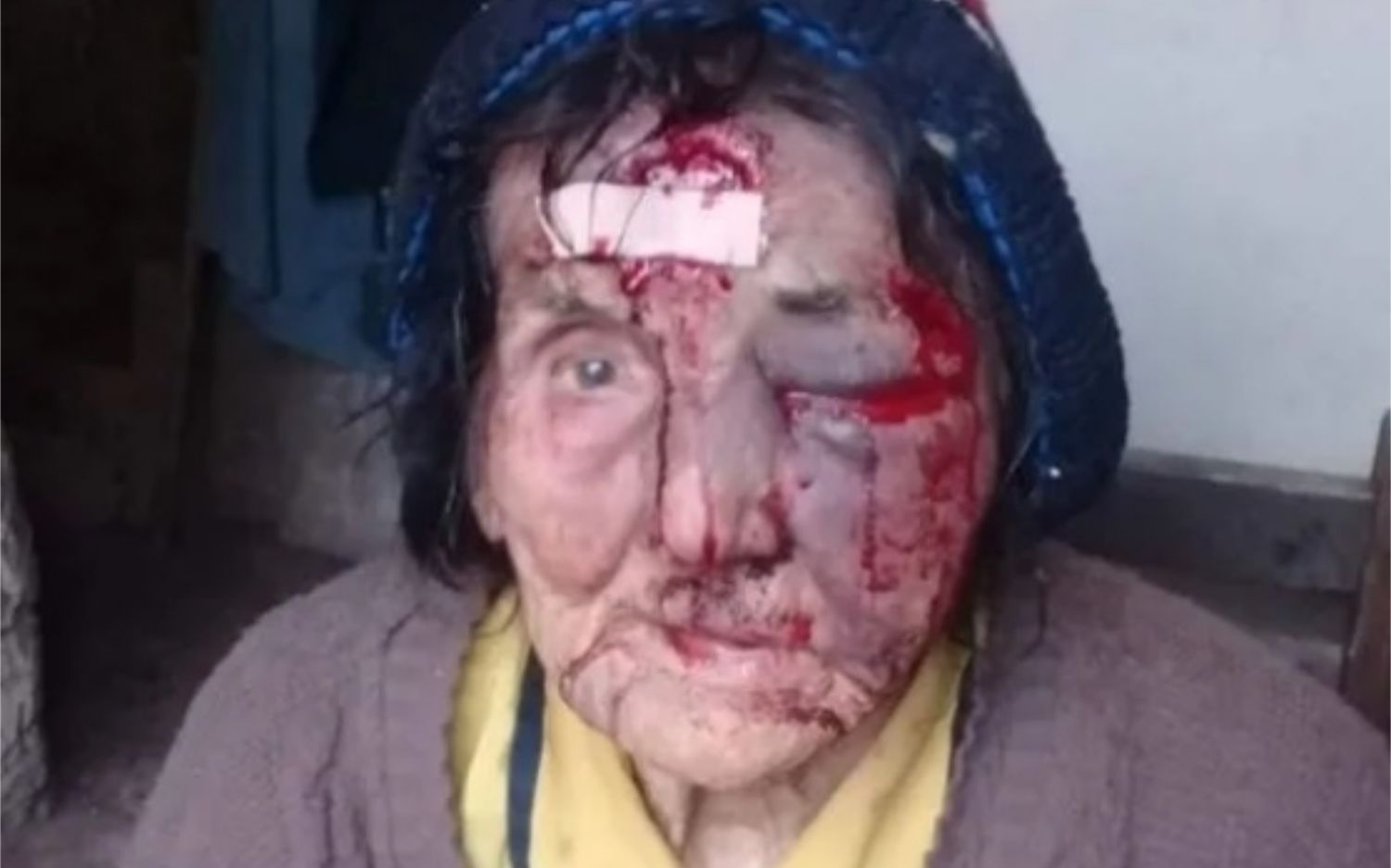 Desfiguraron a golpes a una anciana de 83 años para robarle una garrafa en Almirante Brown