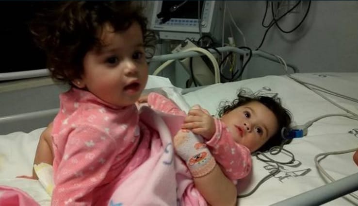 Separaron a siamesas en el Hospital Posadas, una de las niñas falleció