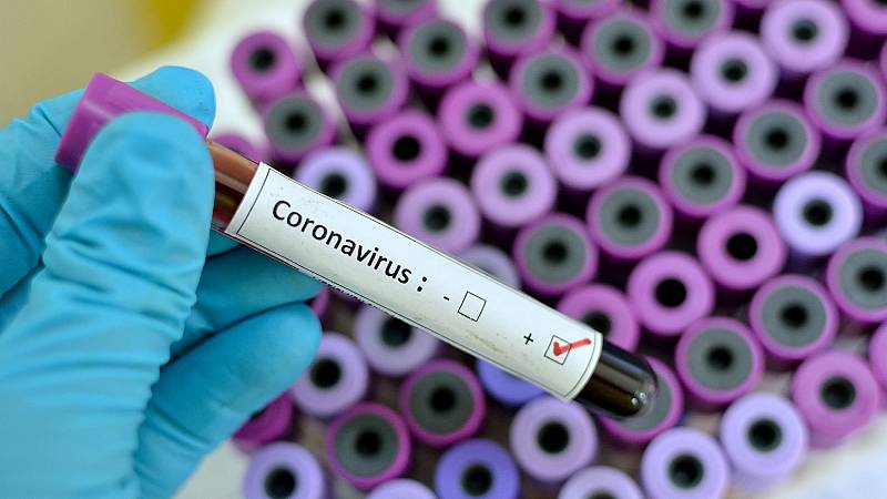 Coronavirus: Cómo se extrae y envía la muestra para saber si una persona tiene COVID-19