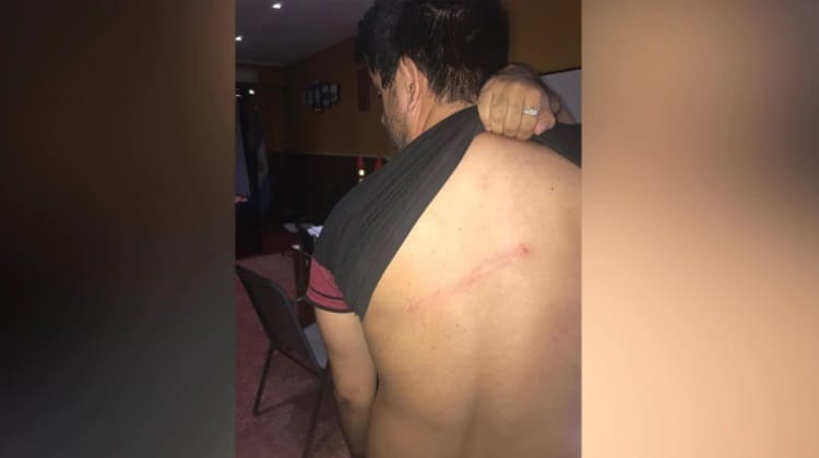 "No nos vamos a dejar amedrentar", dijo el concejal PRO agredido en un timbreo de La Matanza