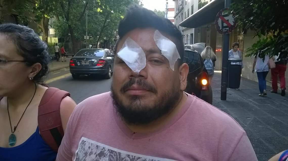 Exdocente perdió la visión de un ojo por un balazo de goma durante la marcha contra la Reforma previsional