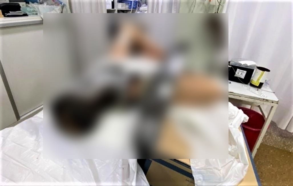 Carnicero perdió tres dedos en una máquina, lo internaron con el aparato y en el hospital viralizaron su foto