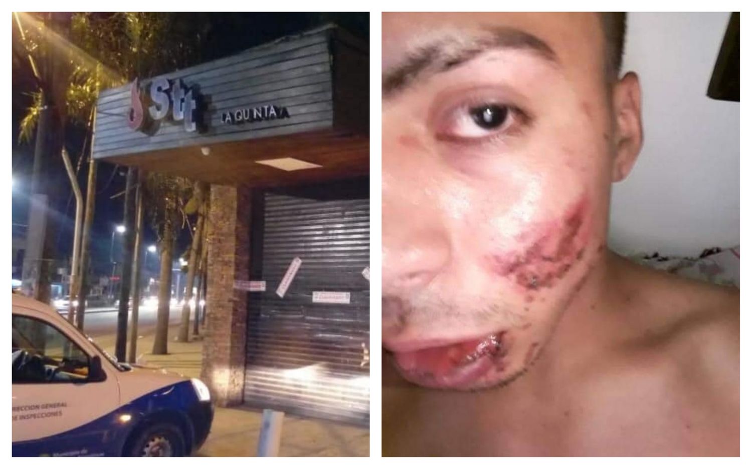 San Miguel: El municipio clausuró un boliche tras la brutal agresión de patovicas a un joven