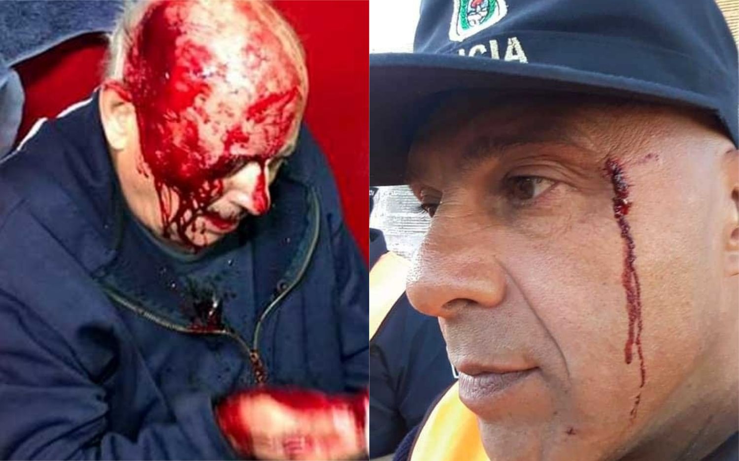 Graves incidentes en la final del torneo del Consejo Federal en Chivilcoy: Cuatro heridos