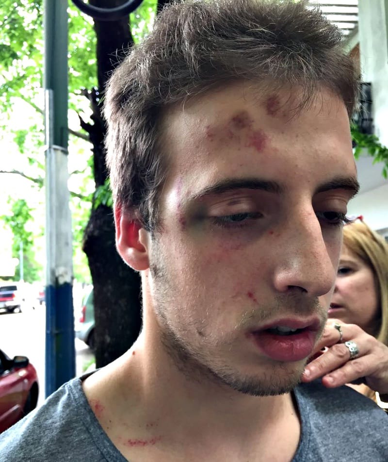 Otra vez rugbiers: Brutal ataque de jugadores de La Plata a un estudiante