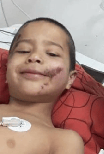 Berazategui: Elias tiene 6 años, lo atropelló un camión, puede perder una pierna y IOMA no autoriza la operación