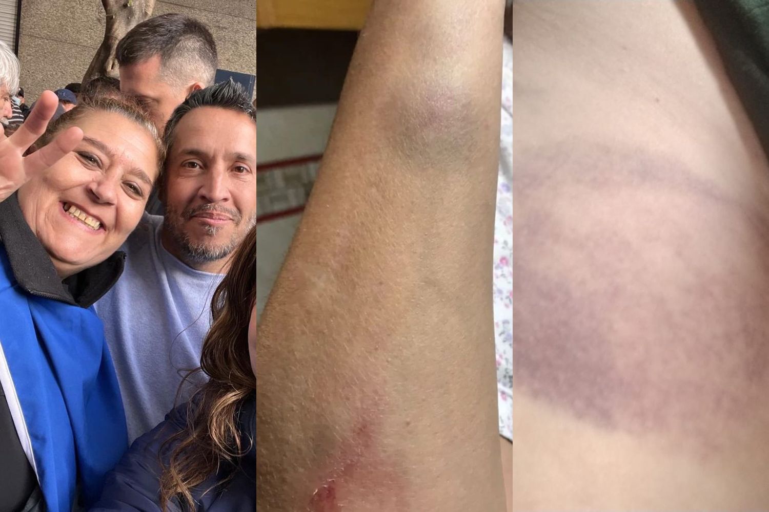 "Nunca viví algo así", dijo la diputada Susana González tras ser agredida por la Policía en la casa de Cristina