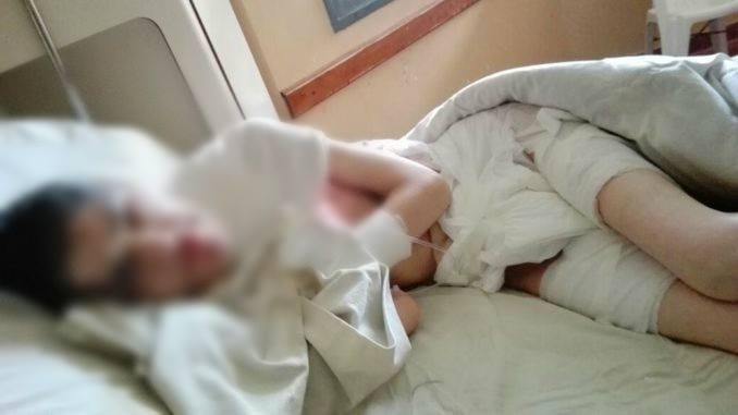 Escándalo en Maipú: "Quemaron viva" a una paciente discapacitada en el Hospital municipal 