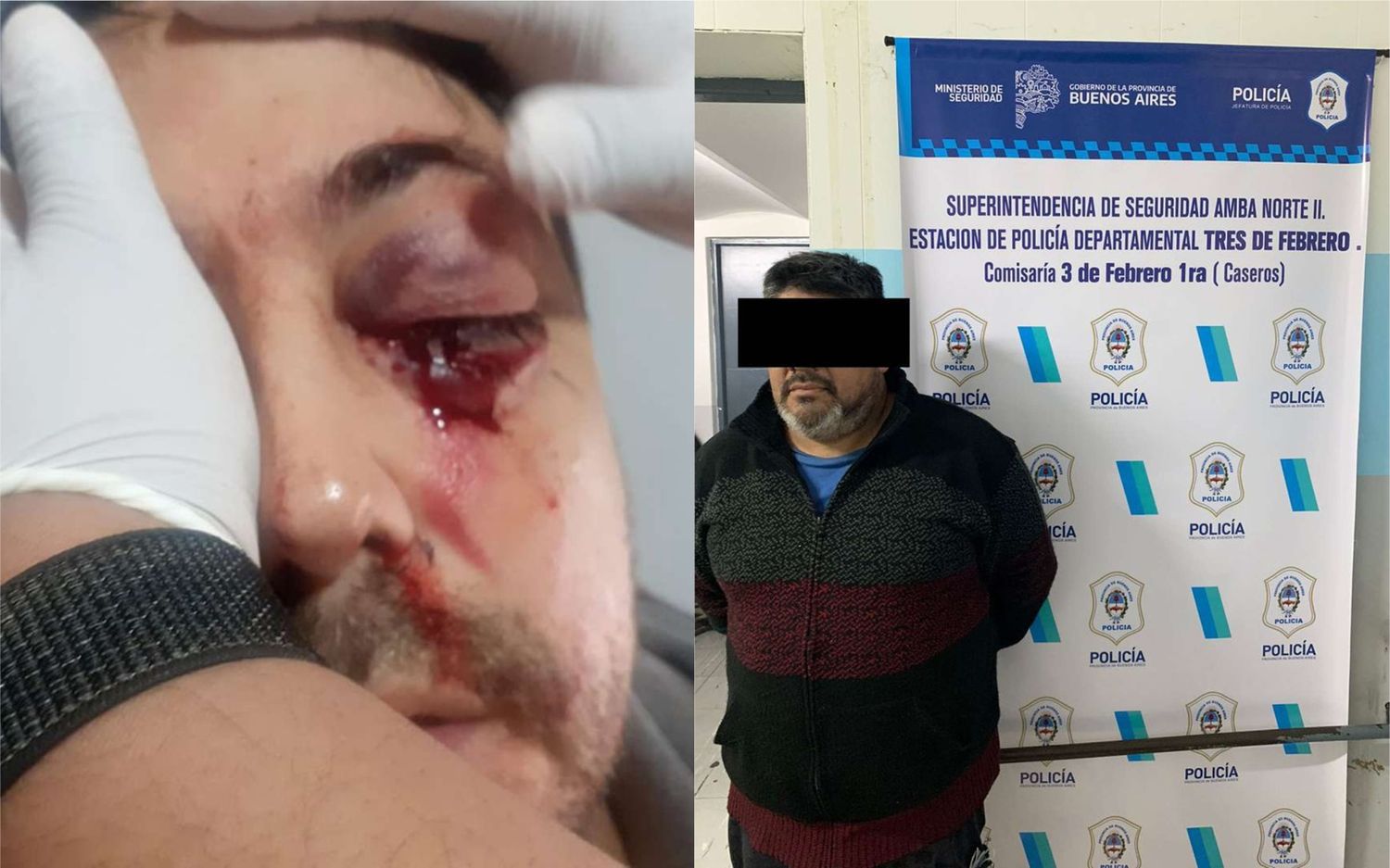 Padres se pelearon por WhatsApp y terminaron a las piñas en un colegio de Caseros: Uno perdió un ojo y otro quedó detenido