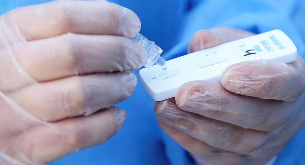 Gobierno bonaerense prohibió la venta en farmacias de test rápidos para detectar COVID