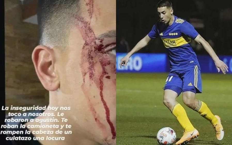 El futbolista de Boca, Agustín Sandez, víctima de un violento robo en Lanús: Le golpearon la cabeza con un arma