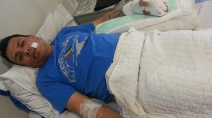 Brutal asalto a chofer de la Línea 378 en La Matanza: Le cortaron un dedo