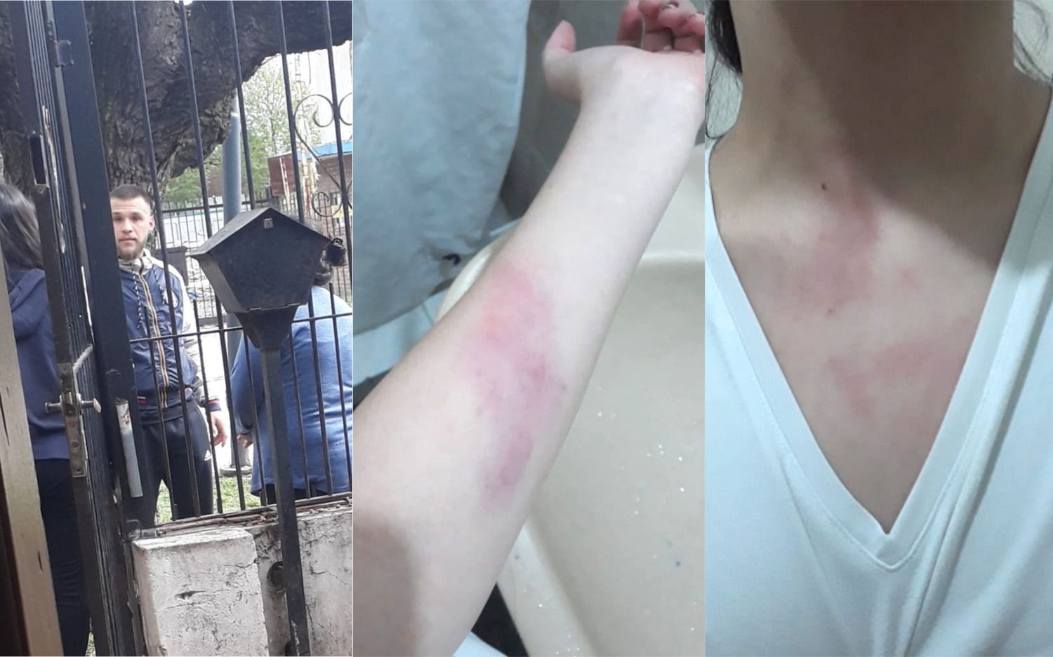 Una joven denunció a un futbolista de San Miguel por violencia de género y publicó fotos de las heridas en su cuerpo