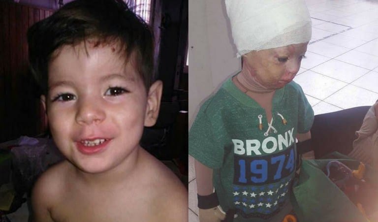 Piden ayuda para un nene quemado y amputado tras un incendio en Berazategui