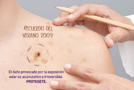 Campaña contra el cáncer de piel en Provincia: Controles gratuitos hasta el 22 de noviembre