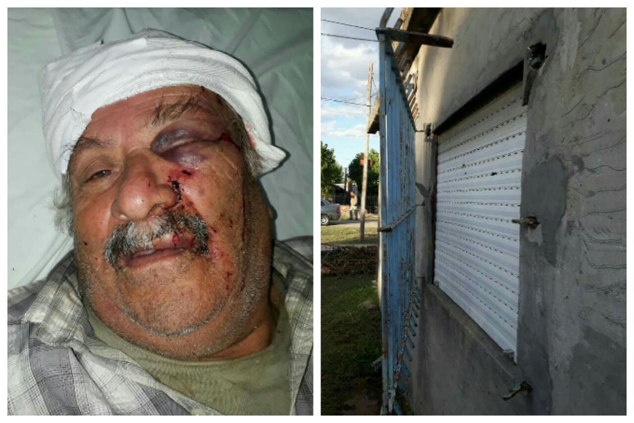 Florencio Varela: Entraron a la casa y lo despertaron a golpes para robarle la jubilación