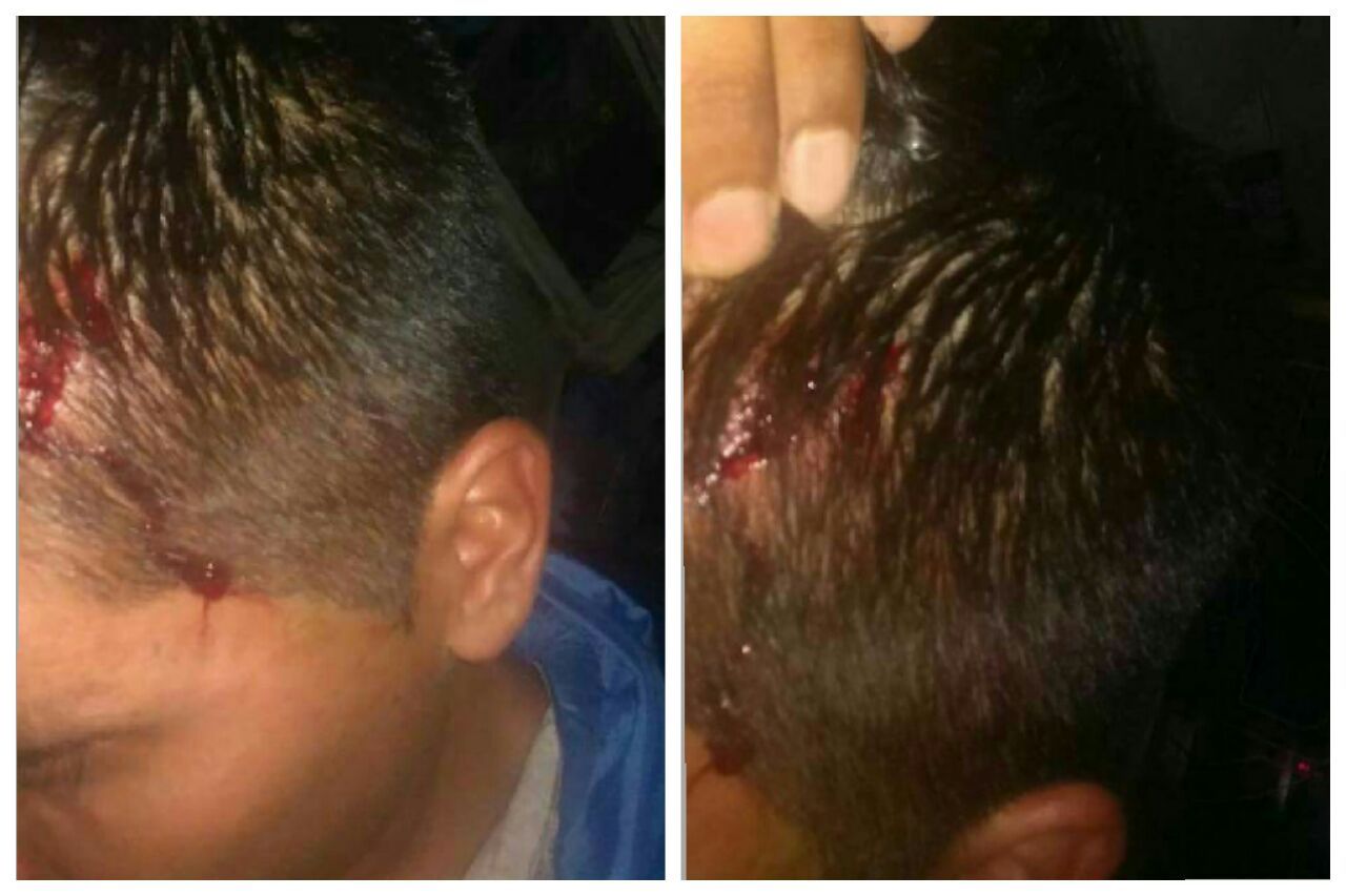 Sigue la locura: Un pasajero atacó a otro colectivero de la línea 373 en Avellaneda