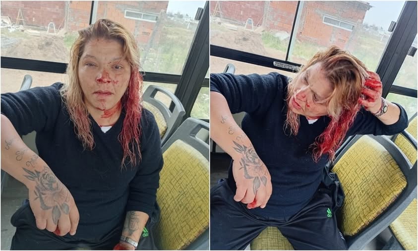 mujer agredida Bahía Blanca