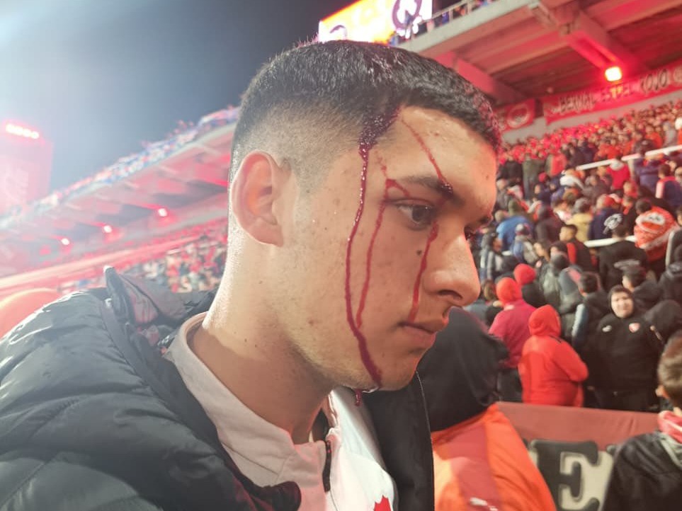 hincha independiente golpeado