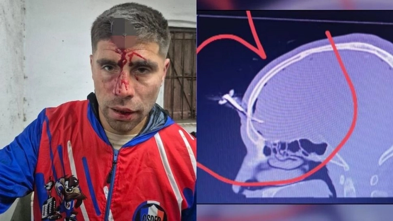 agresión club GEVE Berazategui