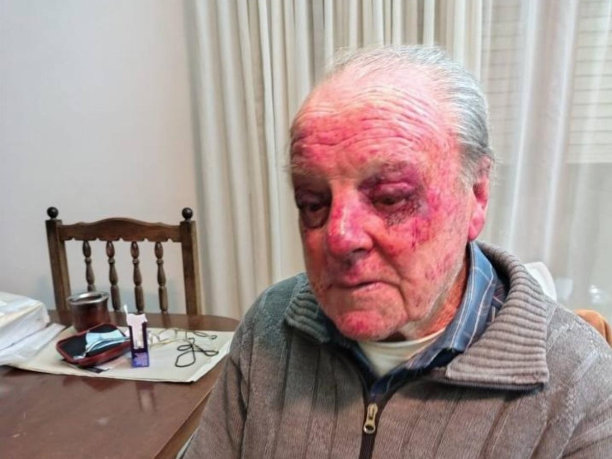 Violenta golpiza a un jubilado de 90 años en Miramar
